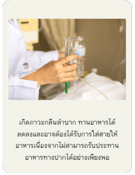 เกิดภาวะกลืนลำบากทานอาหารได้น้อยลง ทำให้น้ำหนักตัวลดและส่งผลต่อภาวะ ทุพโภชนาการ ซึ่งส่งผลให้ภาวะร่างกายอ่อนแอ ฟื้นตัวได้ช้า บางรายอาจต้องได้รับการใส่สายให้อาหารเนื่องจากไม่สามารถรับประทานอาหารทางปากได้อย่างเพียงพอ