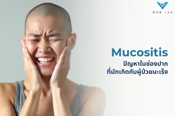Mucositis: ปัญหาในช่องปากที่มักเกิดกับผู้ป่วยมะเร็ง