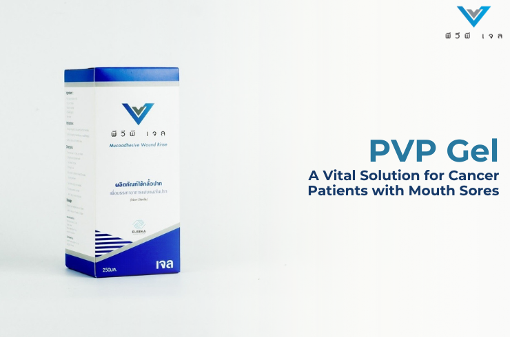 PVP Gel: A Vital Solution for Cancer Patients with Mouth Sores