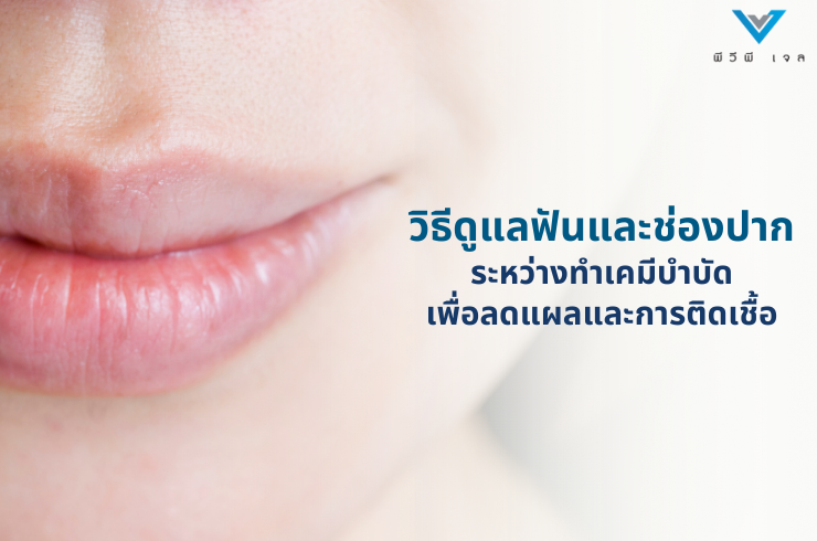 วิธีดูแลฟันและช่องปากระหว่างทำเคมีบำบัด เพื่อลดแผลและการติดเชื้อ