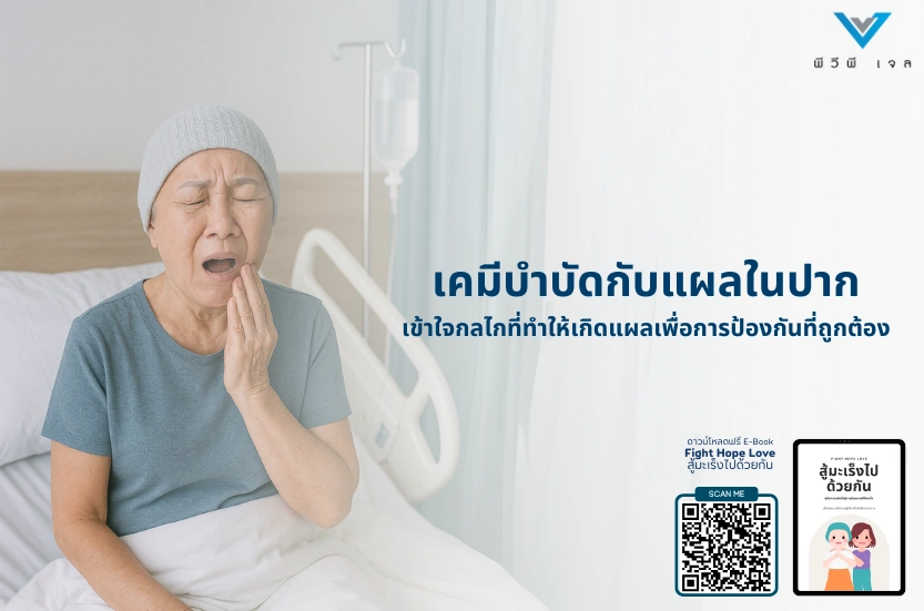 เคมีบำบัดกับแผลในปาก: เข้าใจกลไกที่ทำให้เกิดแผลเพื่อการป้องกันที่ถูกต้อง